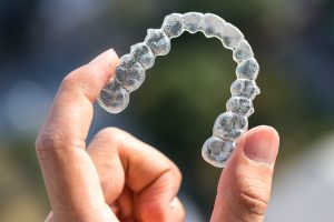 Clear Braces - Dentist In New Mexico