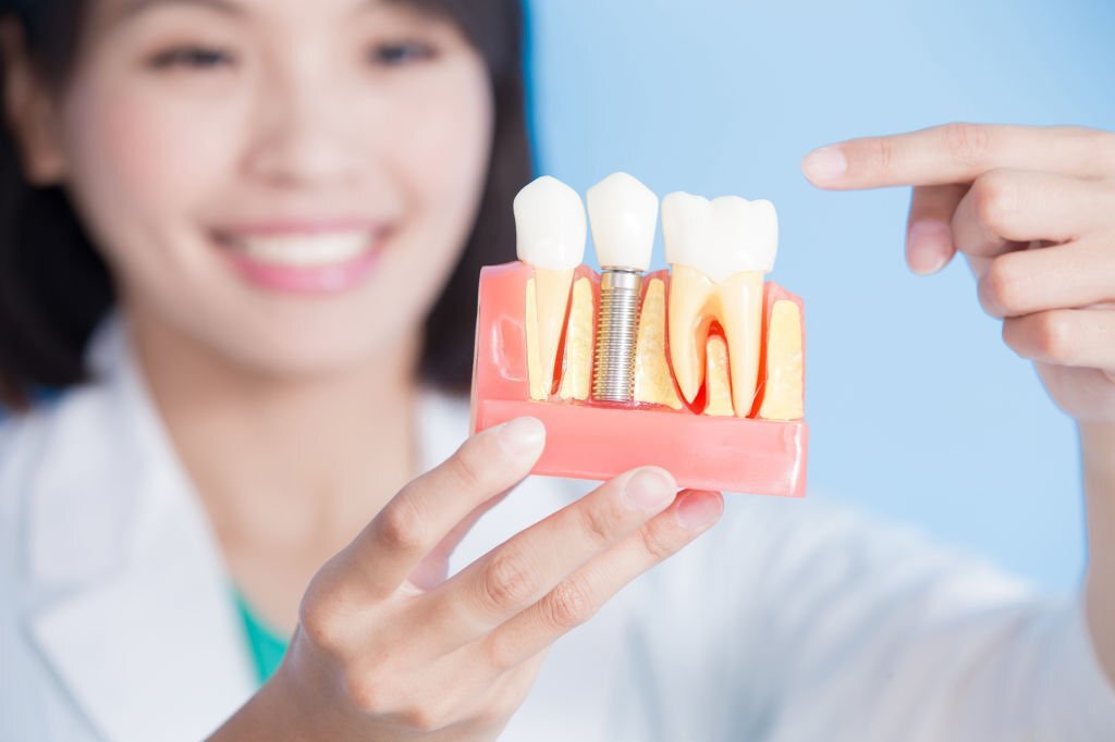 Problems With Dental Implants