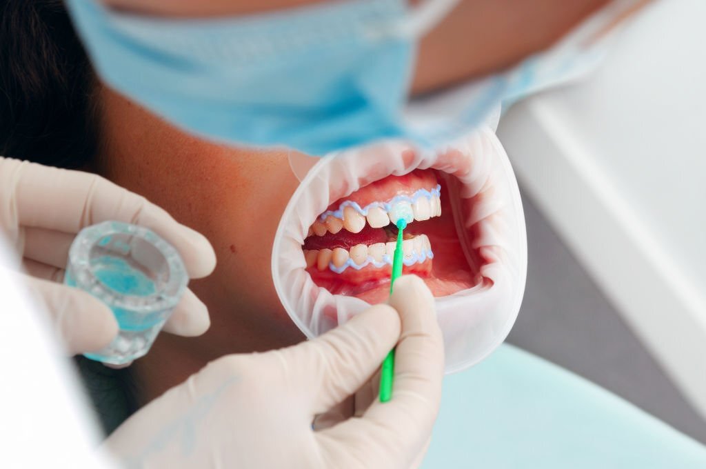 What Are The Benefits And Associated Risks Of Cosmetic Dentistry