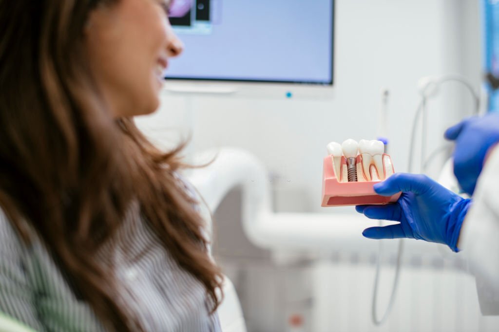 Dental Implants Procedure