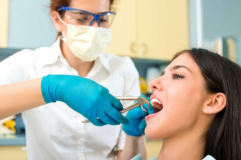 Dental Teeth Pulling: Your Complete Guide From Procedure To Recovery