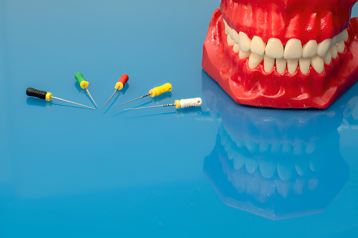 Top Dentist in Bloomfield for Root Canal Procedures: Why Sundance Bloomfield is the Go-To Choice_FI